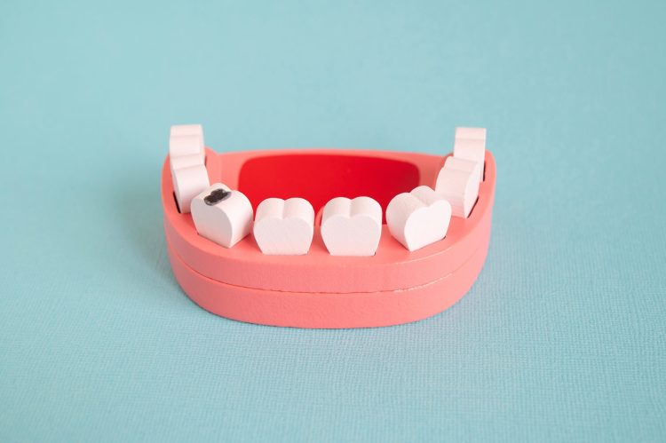 What Are the Signs of Tooth Decay, and Which Dentist Can Help?